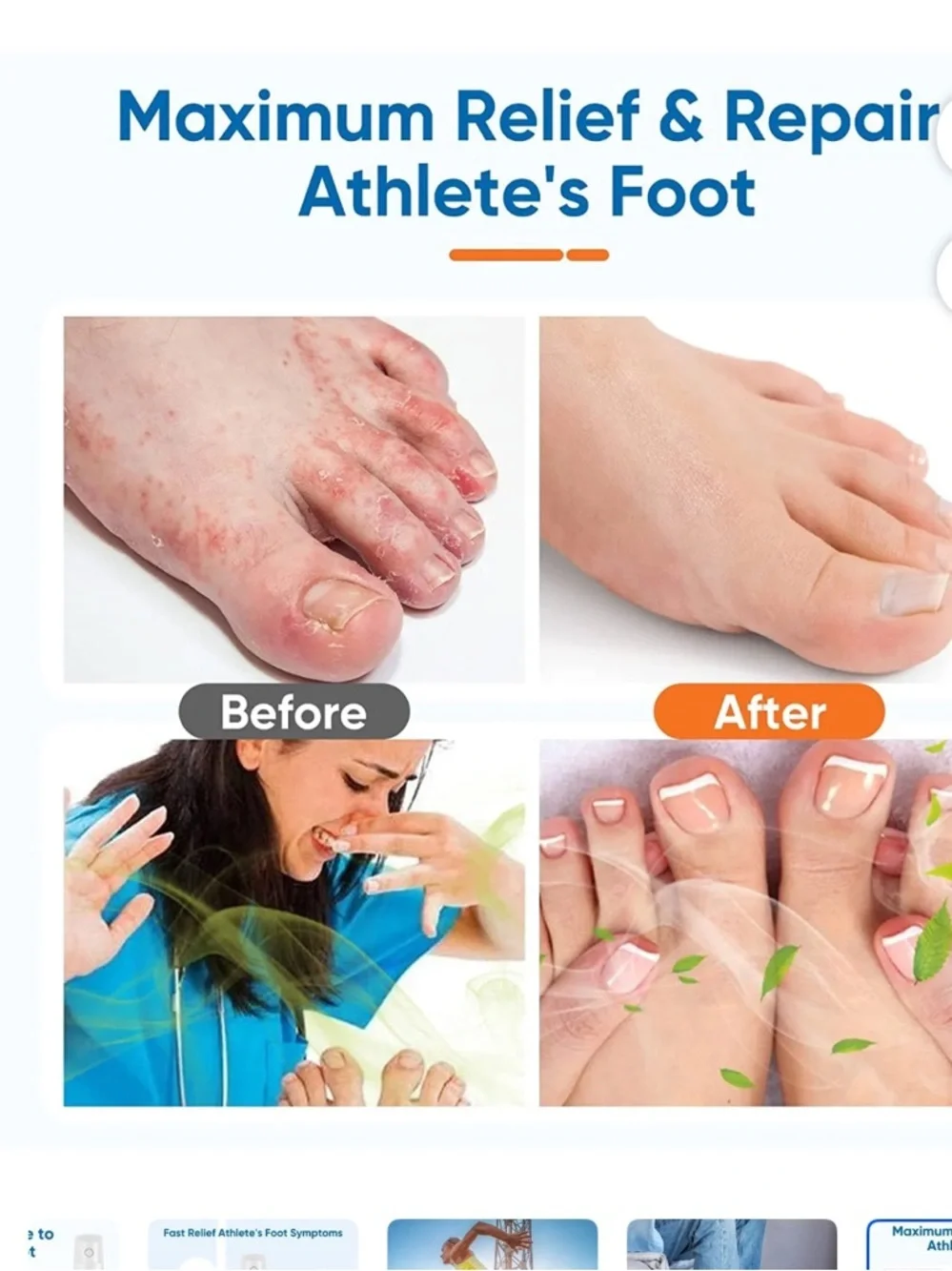 Vifycim Athlete's Foot Spray - Soothing Antifungal Spray set of 3